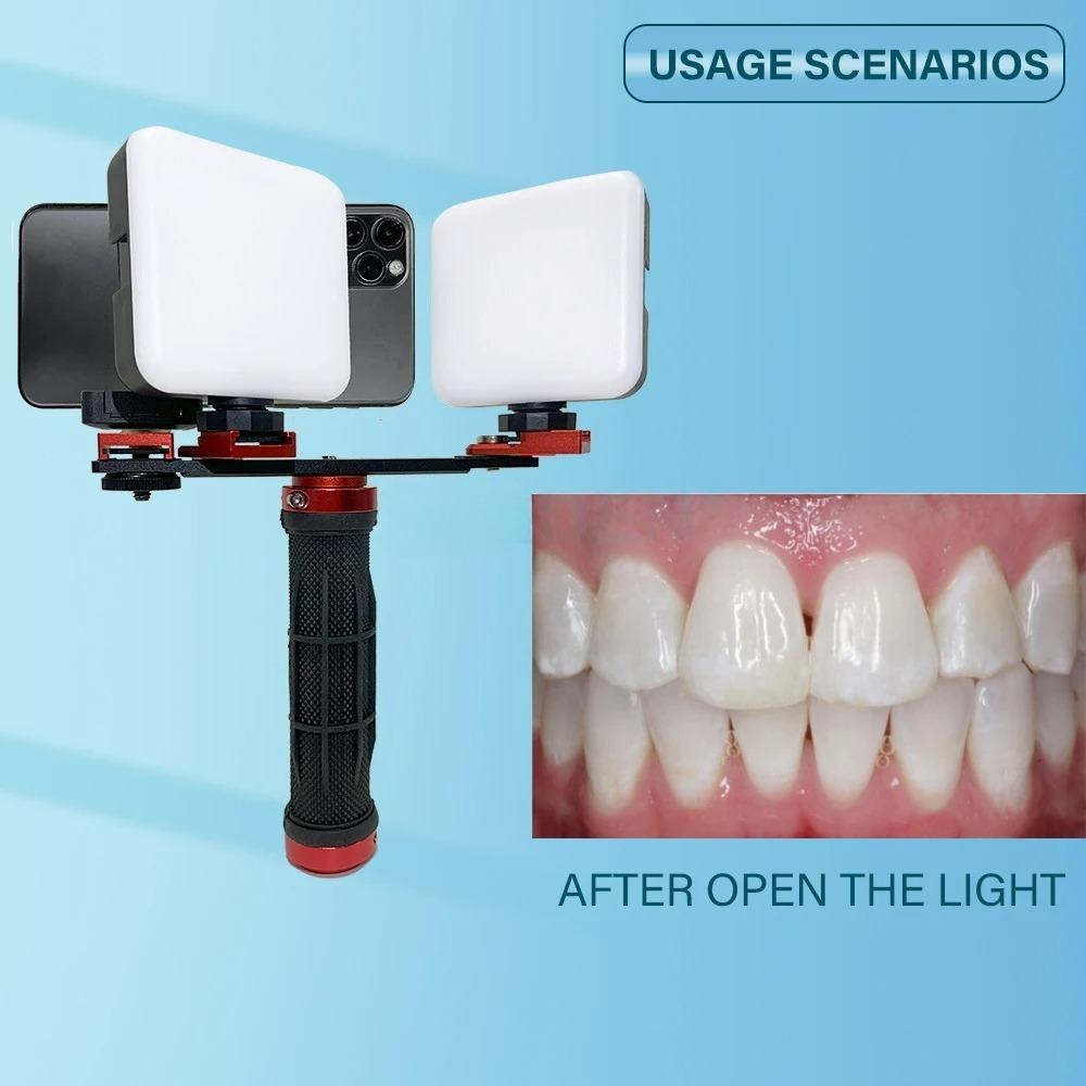 Luce per Fotografia Dentale co - Photography Lighting Accessories recensione e prezzo