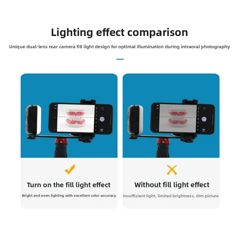 Luce per fotografia dentale, f - Photography Lighting With Flash recensione e prezzo